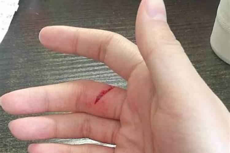 女人梦见自己来月经了什么预兆