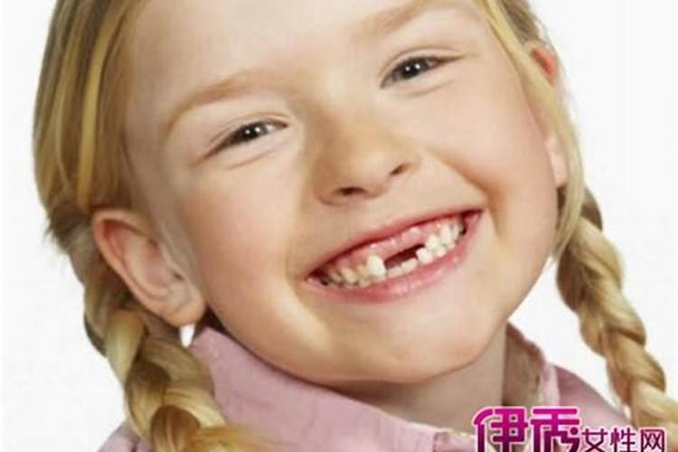 梦见女人掉牙齿的预兆