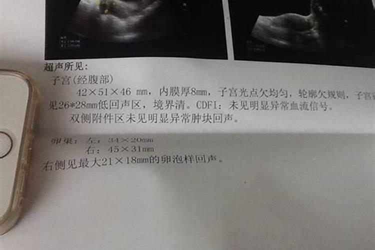 人流后有褐色东西流出来正常吗
