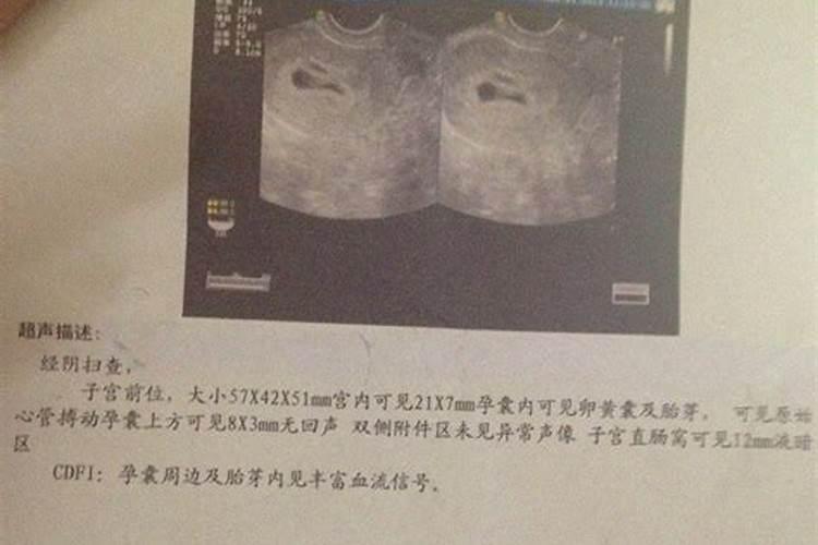 那些被打掉的胎儿最后都到哪里去了？胎儿会感受到痛苦吗？