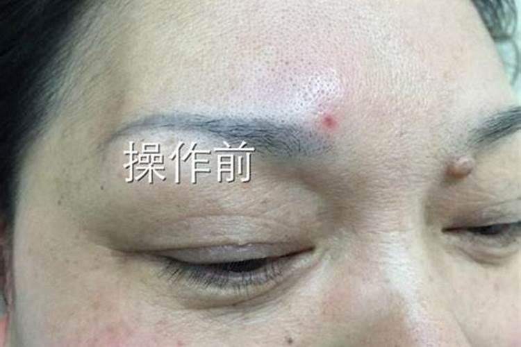 眉峰做了会影响运势吗,眉毛刮了影响运气吗？
