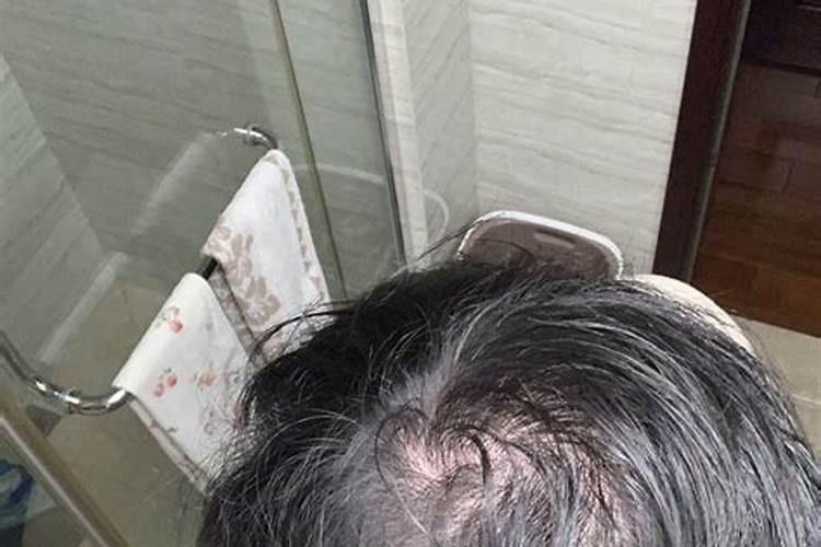 梦见自己秃头是什么预兆