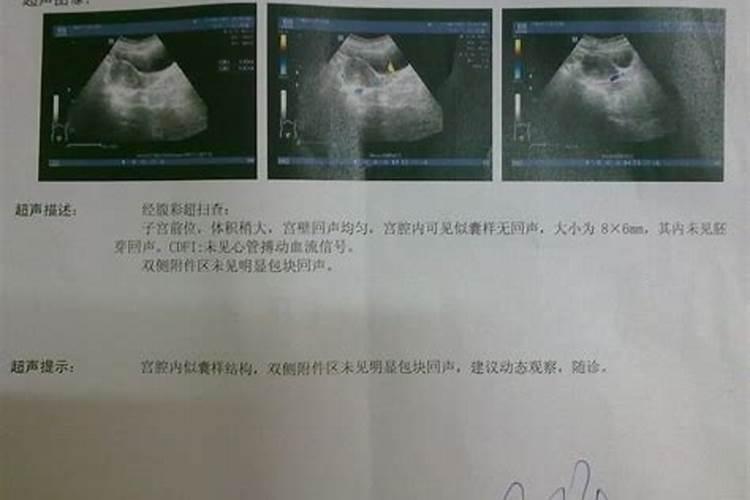 婴灵真的存在吗