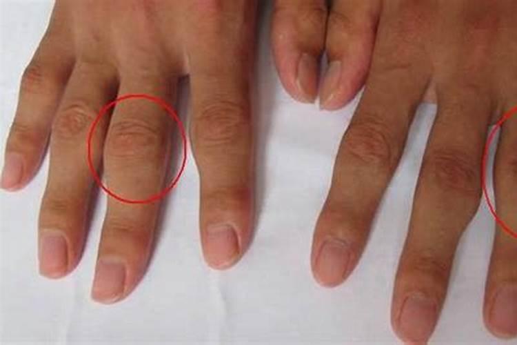 女人手指关节跟自己的婚姻有什么联系