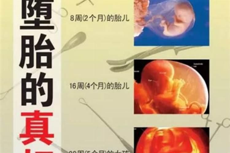 有因果报应吗？堕胎真的会让以后的生活复杂不堪？什么事都倒霉？