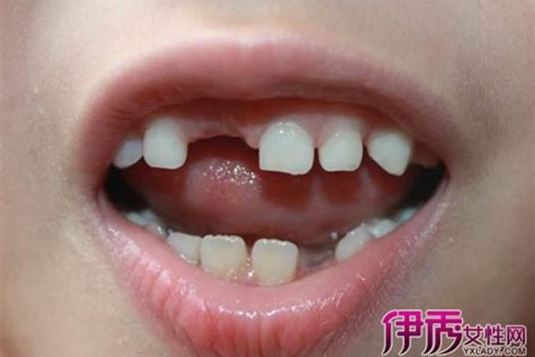 梦见牙齿松动自己拔掉三颗牙的预兆