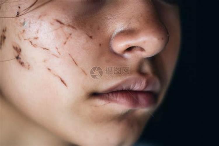 梦见亲弟被别人打了