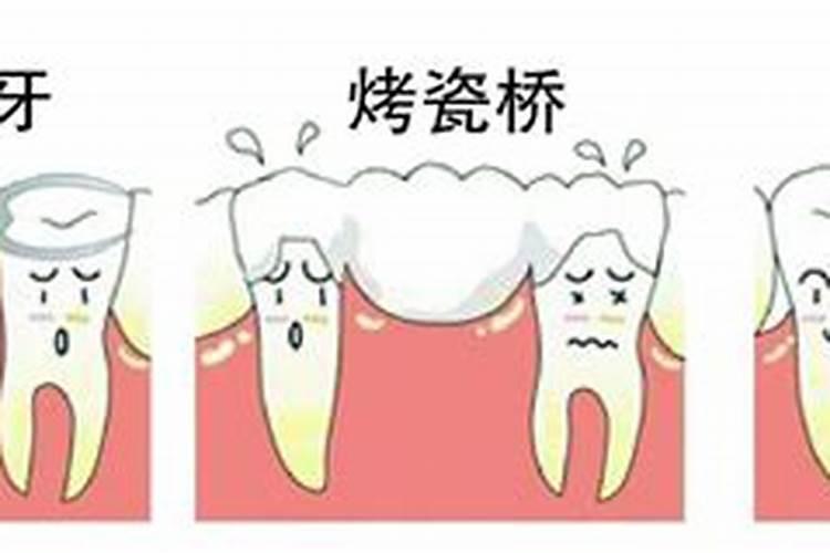 梦到上牙掉了一颗是什么意思