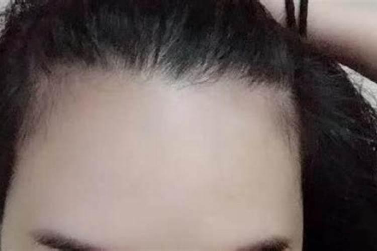 发际线太低会影响我们运势吗